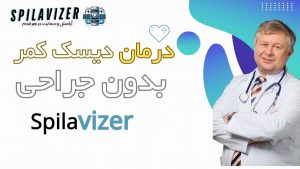 انعطاف‌پذیری کمر پس از استفاده از کمربند فراصوت اسپیلاوایزر: این کمربند با کاهش سفتی عضلات و بهبود جریان خون، به افزایش دامنه حرکتی و انعطاف‌پذیری کمر کمک می‌کند.