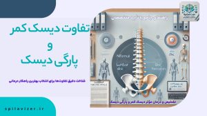 تصویر شاخص مقاله تفاوت دیسک کمر و پارگی دیسک که نمایی از ستون فقرات با دیسک کمر سالم و دیسک پارگی شده را نشان می‌دهد. این تصویر به تفاوت‌های بین دیسک کمر و پارگی دیسک و راهکارهای درمانی آن‌ها می‌پردازد.